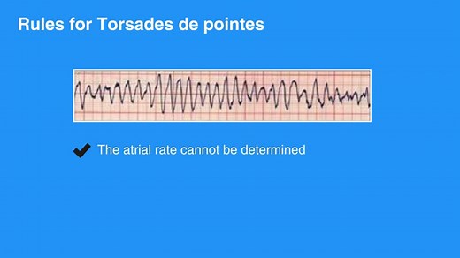Pulseless Ventricular Tachycardia and Ventricular Fibrillation