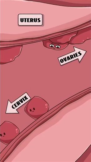 How are "chocolate cysts" formed?