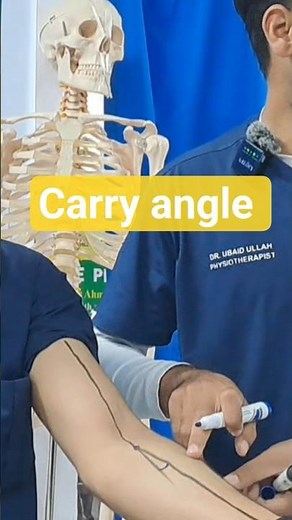 Carry Angle: Valgus or Gunstock? #viral #carryangle #shortvideo