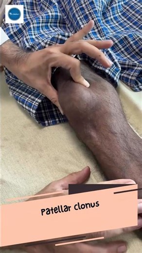 Dr Medica Clinical Cases || Patellar Colonus || Clinical Medicine ||