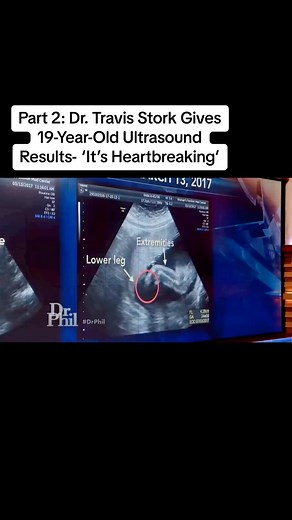 Part 2: Dr. Travis Stork Gives 19-Year-Old Ultrasound Results- ‘It’s Heartbreaking’ #drphilmemes #drphil2023 #viral #trending #drphil #drphilshow #drphilfunny #talkshows | Dr phil- Fans