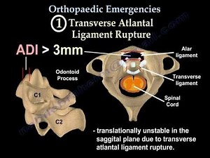 Orthopaedic Emergencies Part 4 - Everything You Need To Know - Dr. Nabil Ebraheim