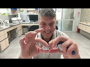 Частични протези – видове, комфорт и изработка | Зъботехник Мариян Маринов