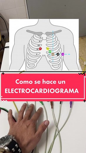Cómo realizar un Electrocardiograma: Colocación y Precauciones