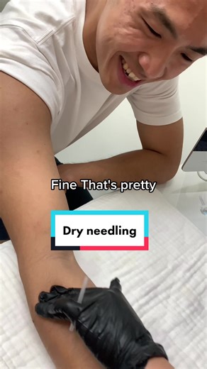 Professional Chiropractic Treatment and Dry Needling Therapy in Singapore