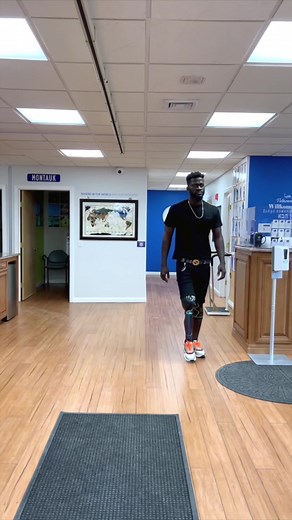 Daniels, an above knee amputee showing off his smooth gait! 🦾🦿 #prosthetic #walking