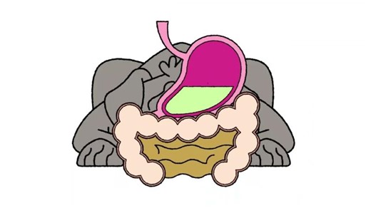 Antibiotics for Diarrhea: Friend or Foe?