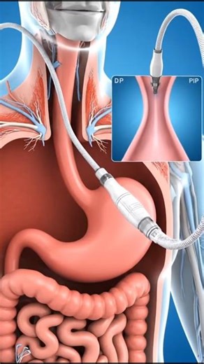 Endoscopy Procedure Explained | 3D Medical Visualization