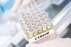 Gewissheit bei Corona: Schnelle PCR-Tests – Sind sie die Lösung?