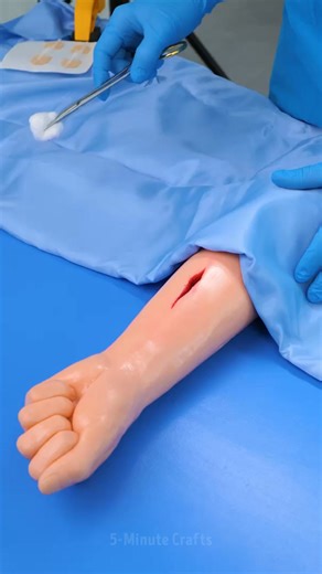 44K views · 106 reactions | Taking care of a cut or scrape the safe way 啕 | 5-Minute Crafts House | Facebook