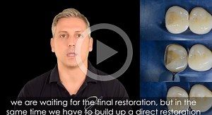 36K views · 218 reactions |  Is the auto-matrix definitively dead?...