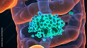 3D Visualization of a Cell Cluster Attacking Healthy Cells