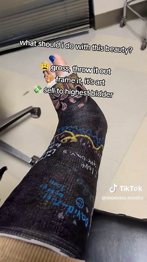 Saying Goodbye to My Decorated Leg Cast