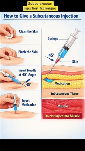 SUBCUTANEOUS INJECTION TECHNIQUE - HOW TO GIVE SUBCUTANEOUS INJECTION - MEDTALKS