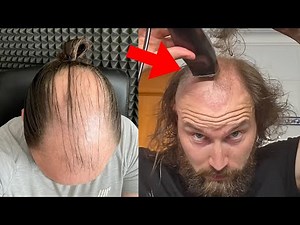 SHAVING MY BALDING HAIR OFF