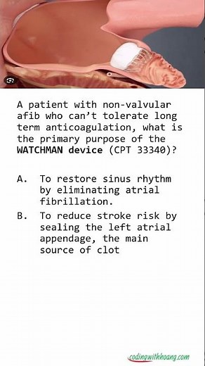WATCHMAN Device: Know This Before the Exam