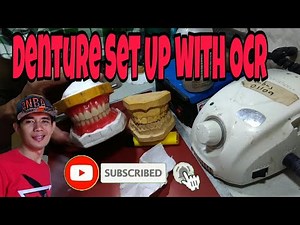 Complete Denture Teeth Setting GUIDE How to set up Upper and lower Dentures for try in.