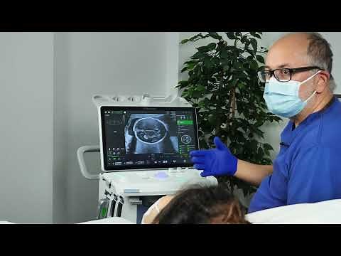 Voluson™ SonoLyst - Suite of AI Tools to Help Automatically Identify Fetal Anatomy