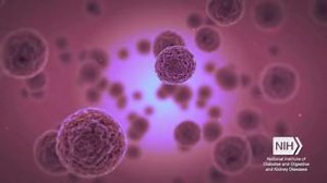 Today is World Lupus Day 曆  Lupus is a chronic autoimmune disorder in which the body's immune system cannot tell the difference between cells, viruses, organs, and bacteria. As a result, the body's immune system attacks the body's healthy cells and organs. Learn more about lupus in this video with NIDDK Director Dr. Griffin P. Rodgers and Dr. Stephen Katz. | National Institute of Diabetes and Digestive and Kidney Diseases (NIDDK) | Facebook