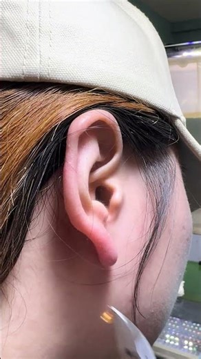 Baby Ear Plug Mishap – What Every Parent Should Know