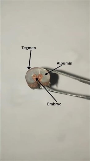 parts of monocot seed (date palm horizontal section)