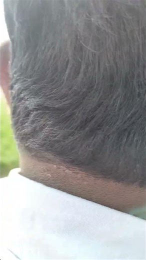 🫰🫰🫶🫶💕🥰😍