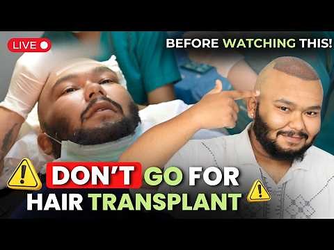 Hair Transplant Surgery | Hair Transplant Live Video | Hair Transplant Procedure | QHT Clinic #qht