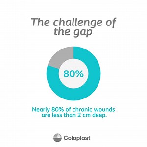80% of chronic wounds are up to 2 cm deep. What is the most common wound depth you see in the wounds you treat? Comment below, we'd love to know! And did you remember to order your 'Mind The Gap'? The kit will help you get the wound depth just right for proper treatment. Get yours here: http://bit.ly/MindTheGapKit | Coloplast Wound and Skin Care