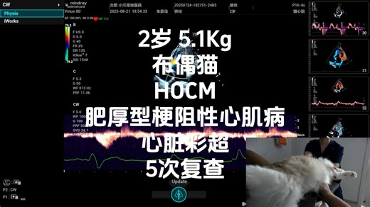 2岁 5.1Kg 布偶猫 HOCM(肥厚型梗阻性心肌病) SAM(二尖瓣收缩期前向运动) LVOTO(左室流出道动态梗阻) 心脏彩超 双侧切面 第5次复
