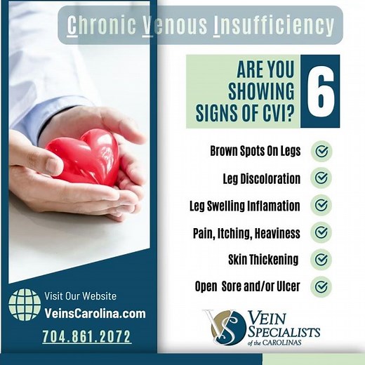 Understanding Brown Spots on Legs: Chronic Venous Insufficiency