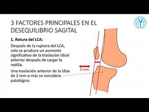 Desequilibrio sagital de la rodilla, inestabilidad de rodilla