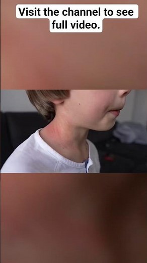 Milk Allergy vs. Lactose Intolerance#Milk #Dairy #LactoseIntolerance #PlantBased #HealthTips