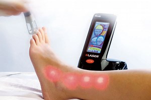 Laser Therapy | The Footcare Clinic