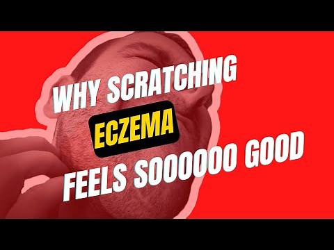 Why Scratching Eczema Feels Good (and How to Relieve The Itch)