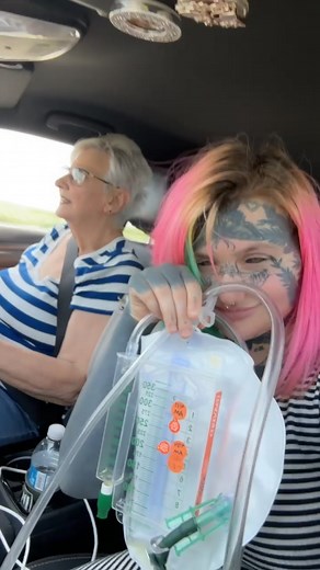 On my way to get this ripped out, iykyk.