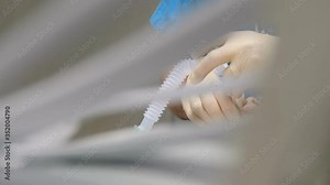 Surgical equipment, surgery oxygen machine. blurred patient under anesthesia with mask and tube on face, procedure in operating room. Artificial respiration tube inserted into patient shot through