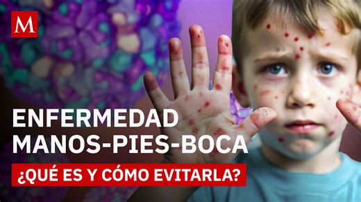 ¿Qué es la enfermedad de manos, pies y boca?
