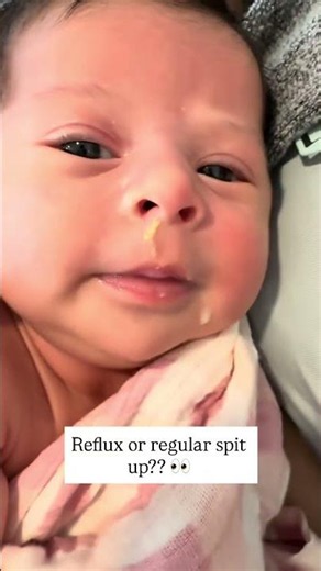 Reflux or regular spit up?