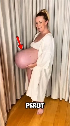 Perutnya Tampak Sangat Besar dan Aneh, Tapi Inilah Alasannya 🤗 #shortvideo