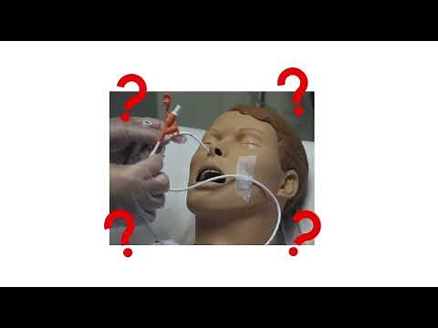 NG Tube for Bowel Obstruction || What's the Evidence? 🕖