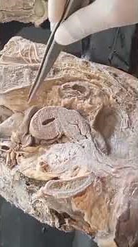 Mid saggital section of female pelvic | Dissection of female pelvic | Uterus| Bladder