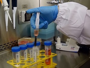 Isolation and Activation of Murine Lymphocytes