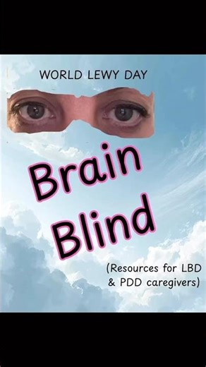 Slow visual processing in Lewy Body Dementia