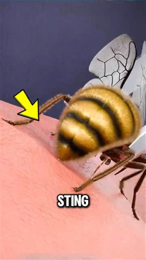 🐝 Bee Sting? Here’s What Really Happens to Your Body!