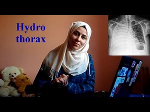 Hydrothorax