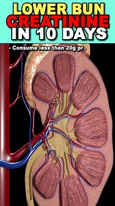 Lower Bun Creatinine in 10 Days! #kidneydisease #kidneyfailure #dialysis #chronickidneydisease #diabetes #highbloodpressure #creatinine #kidneyrepair #kidneyhealth #ckd #00kidney | Health support for kidney dialysis