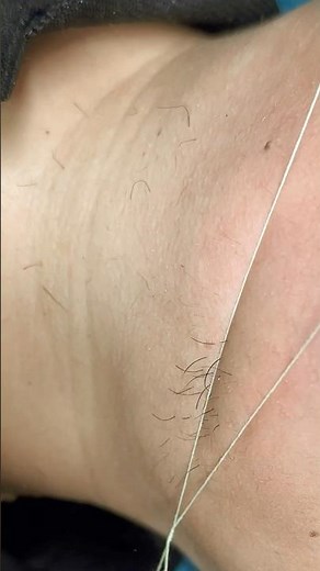 Removing thick/hormonal hair under the chin with thread #threading #facethreading #hairremoval #fy