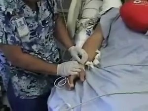 Arterial Line Removal Nursing Lecture