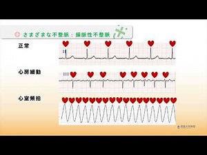 徳島大学病院「TVいきいきらいふ」第192回 不整脈から命を守る① －不整脈の徴候・症状と検脈の仕方－