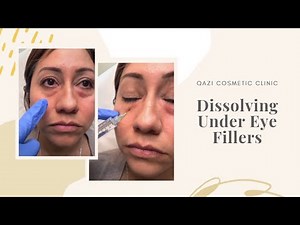 Dissolving Under-Eye Fillers | Live with Dr. Nadir Qazi